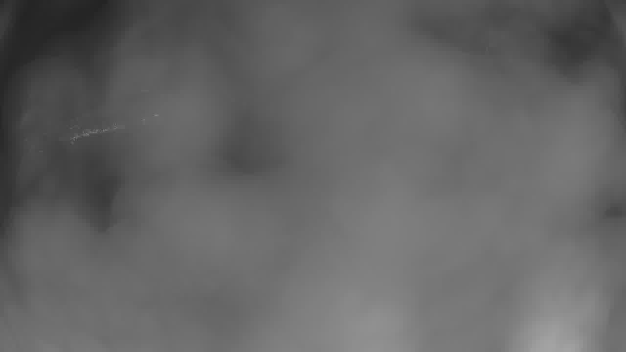 Peak 7 still, 0″ new snow in 24 h